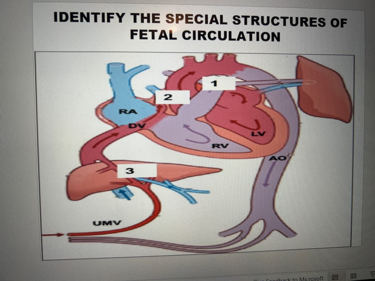 IDENTIFY THE SPECIAL STRUCTURES OF
FETAL CIRCULATION
RA
UMV
DV
3
2
RV
L
AO
Feedback to Microsoft
12
品
P