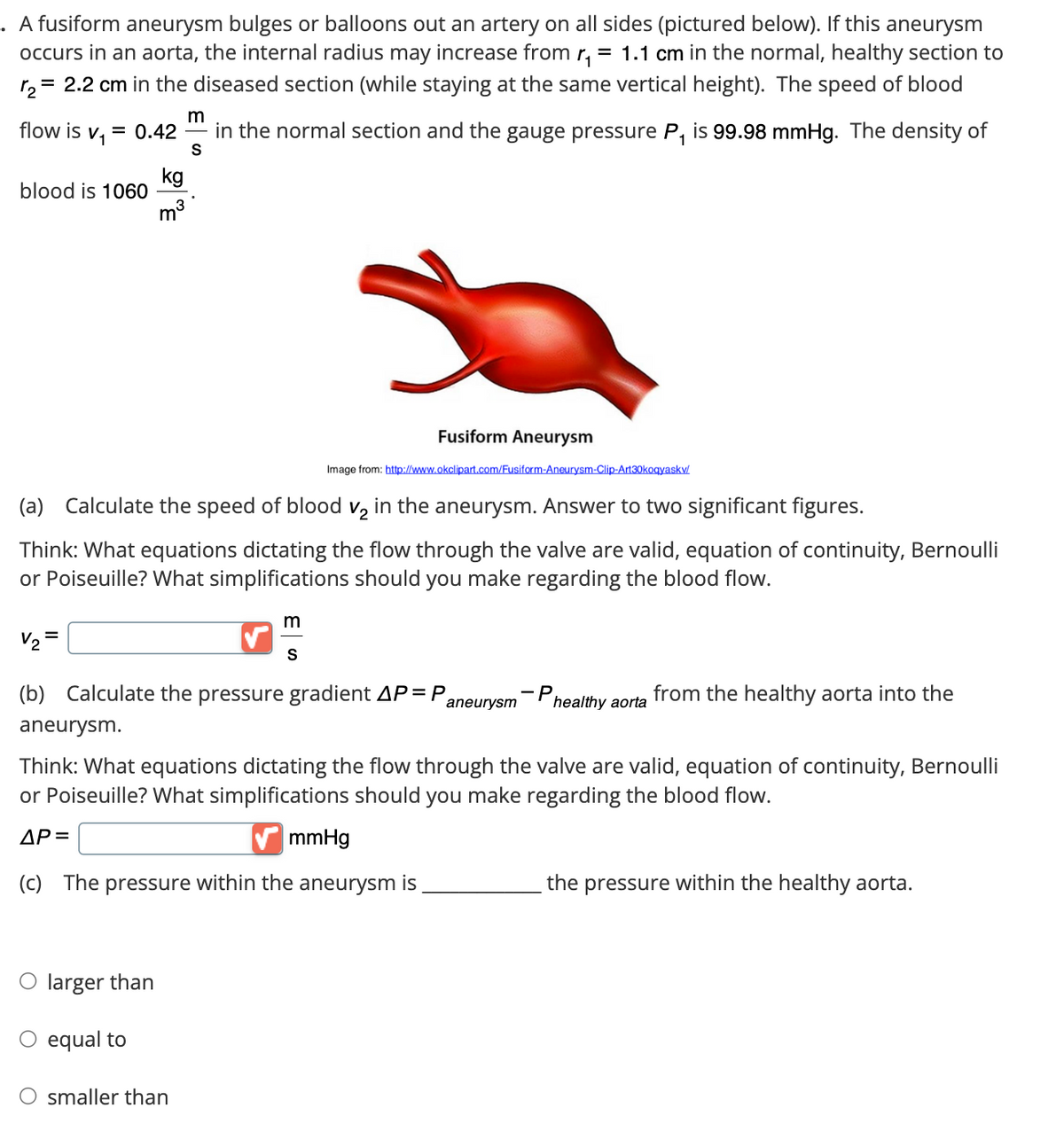 A fusiform aneurysm bulges or balloons out an artery on all sides (pictured below). If this aneurysm
occurs in an aorta, the internal radius may increase from r₁ = 1.1 cm in the normal, healthy section to
12= = 2.2 cm in the diseased section (while staying at the same vertical height). The speed of blood
m
flow is v₁ = 0.42
in the normal section and the gauge pressure P₁ is 99.98 mmHg. The density of
1
S
blood is 1060
kg
m³
Fusiform Aneurysm
Image from: http://www.okclipart.com/Fusiform-Aneurysm-Clip-Art30koqyaskv/
(a) Calculate the speed of blood v2 in the aneurysm. Answer to two significant figures.
Think: What equations dictating the flow through the valve are valid, equation of continuity, Bernoulli
or Poiseuille? What simplifications should you make regarding the blood flow.
m
V₂ =
S
(b) Calculate the pressure gradient AP = P
aneurysm
healthy aorta
from the healthy aorta into the
aneurysm.
Think: What equations dictating the flow through the valve are valid, equation of continuity, Bernoulli
or Poiseuille? What simplifications should you make regarding the blood flow.
AP=
mmHg
(c) The pressure within the aneurysm is
the pressure within the healthy aorta.
O larger than
○ equal to
O smaller than