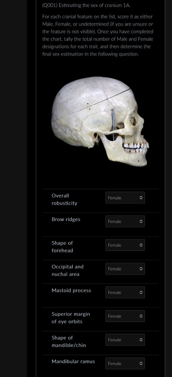 (Q001) Estimating the sex of cranium 1A.
For each cranial feature on the list, score it as either
Male, Female, or undetermined (if you are unsure or
the feature is not visible). Once you have completed
the chart, tally the total number of Male and Female
designations for each trait, and then determine the
final sex estimation in the following question.
Overall
robusticity
Female
Brow ridges
Female
Shape of
Female
forehead
Occipital and
Female
nuchal area
Mastoid process
Female
Superior margin
Female
of eye orbits
Shape of
Female
mandible/chin
Mandibular ramus
Female