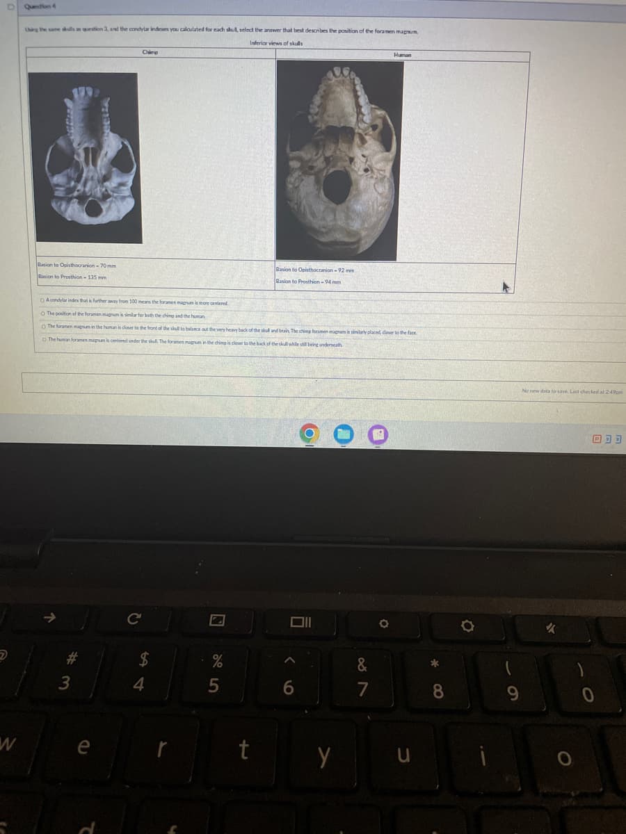 Human
Question 4
Uhing the same skulls an question 3, and the condylar indexes you calculated for each skull, select the answer that best describes the position of the foramen magnum
Inferior views of skulls
Chimp
Rasion to Opisthocranion-70 mm
Basion to Prosthion-135 mm
Basion to Opisthocranion-92 mm
Basion to Prosthian-94 mm
OA condylar index that is further away from 100 means the foramen magnum is more centered
O The position of the foramen magnum is similar for both the chimp and the human
O The foramen magnum in the human is closer to the front of the skull to balance out the very heavy back of the skull and brain. The chimp foramen magnum is similarly placed, closer to the face
O The human foramen magnum is centered under the skull. The foramen magnum in the chimp is closer to the back of the skull while still being underneath
#3
3
ર
C
$
st
4
75
%
W
e
r
t
て
9
Y
87
&
u
No new data to save. Last checked at 2:49pm
8
)
9
0