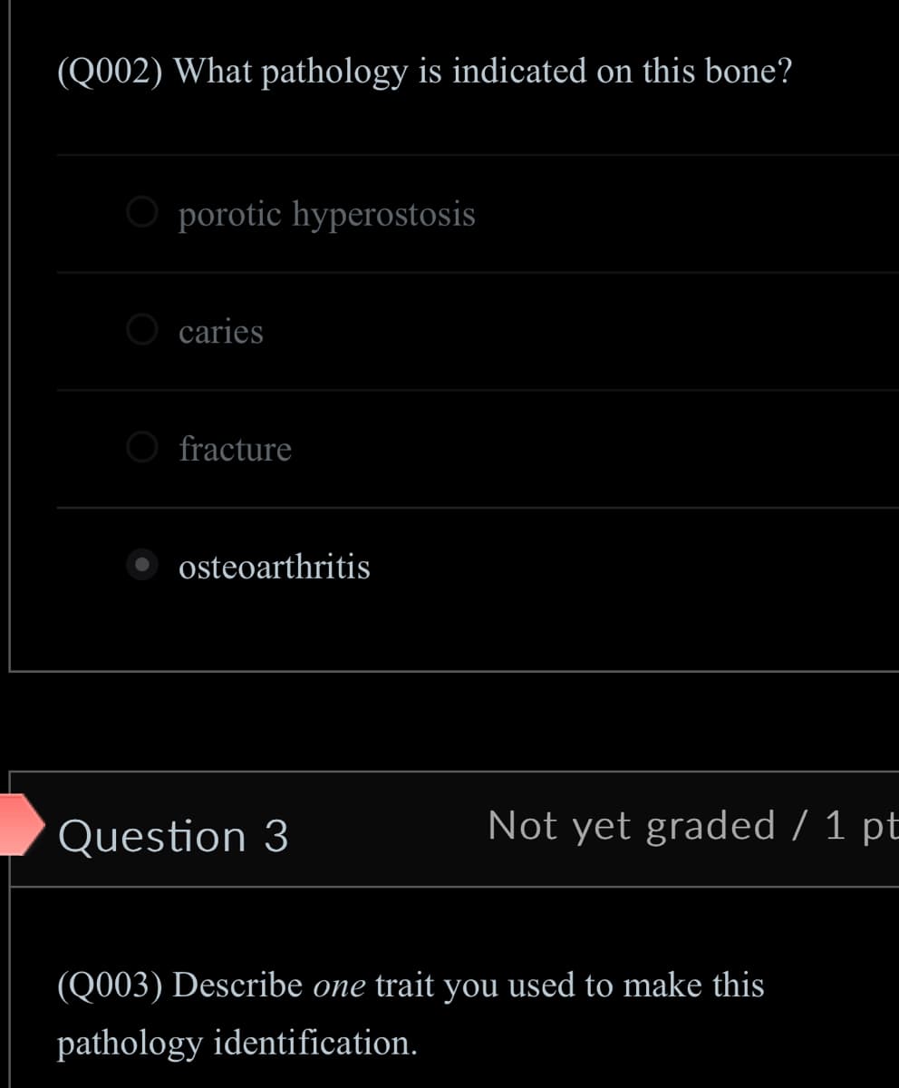 (Q002) What pathology is indicated on this bone?
Oporotic hyperostosis
caries
fracture
osteoarthritis
Question 3
Not yet graded / 1 pt
(Q003) Describe one trait you used to make this
pathology identification.