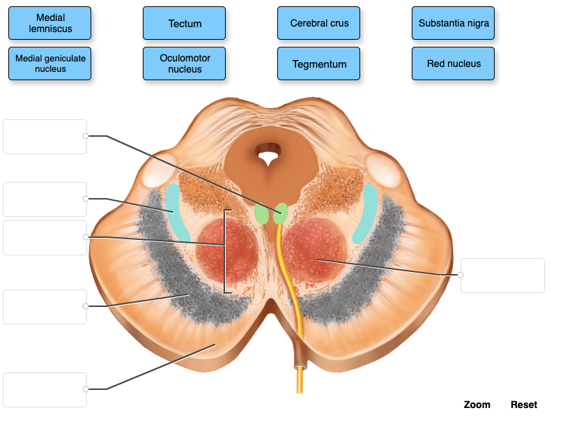 Medial
lemniscus
Medial geniculate
nucleus
Tectum
Oculomotor
nucleus
Cerebral crus
Tegmentum
Substantia nigra
Red nucleus
Zoom
Reset