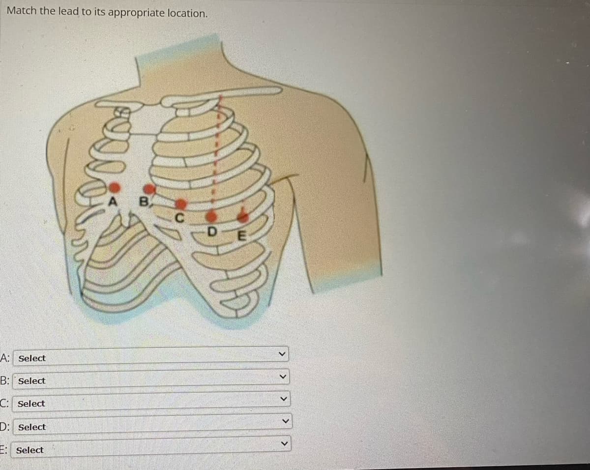 Match the lead to its appropriate location.
A:
Select
B: Select
C: Select
D: Select
Select
50DD
V