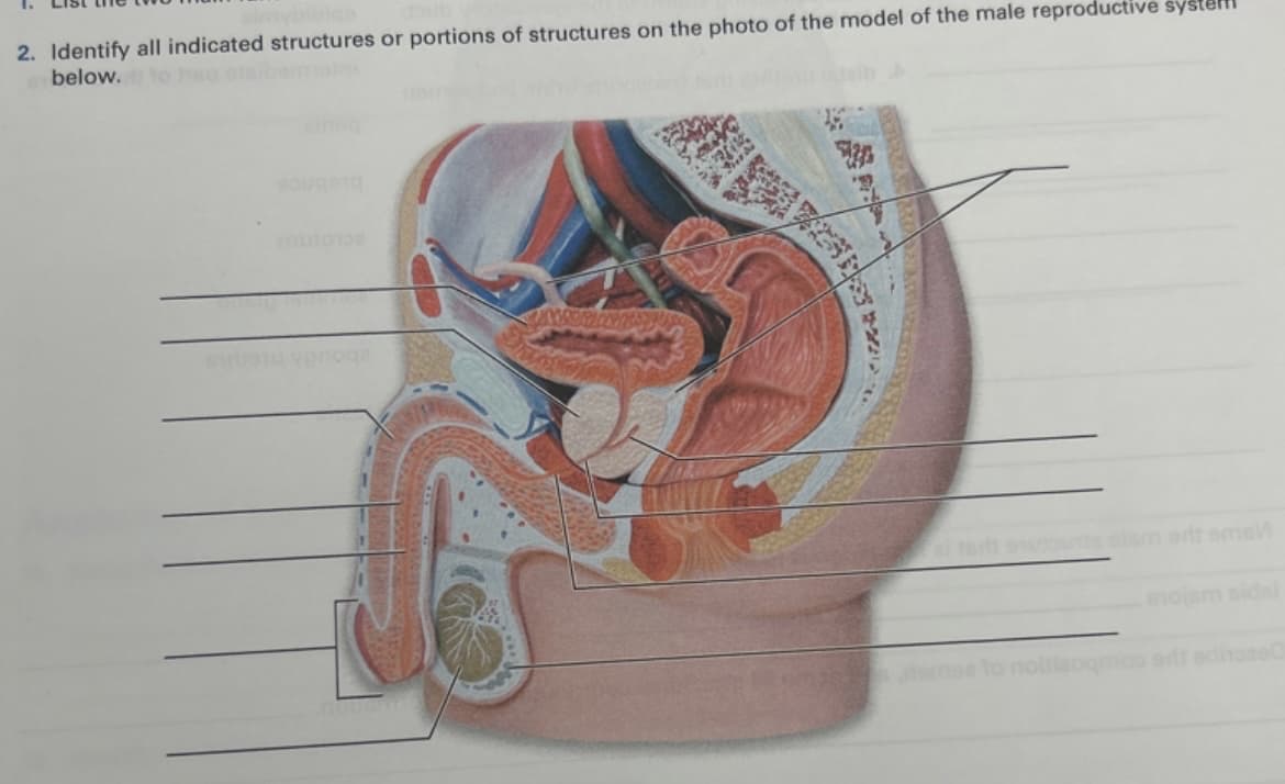 2. Identify all indicated structures or portions of structures on the photo of the model of the male reproductive syste
below. to heq olibaoni
dalam ert ems/
enojam sids
erit edhoes