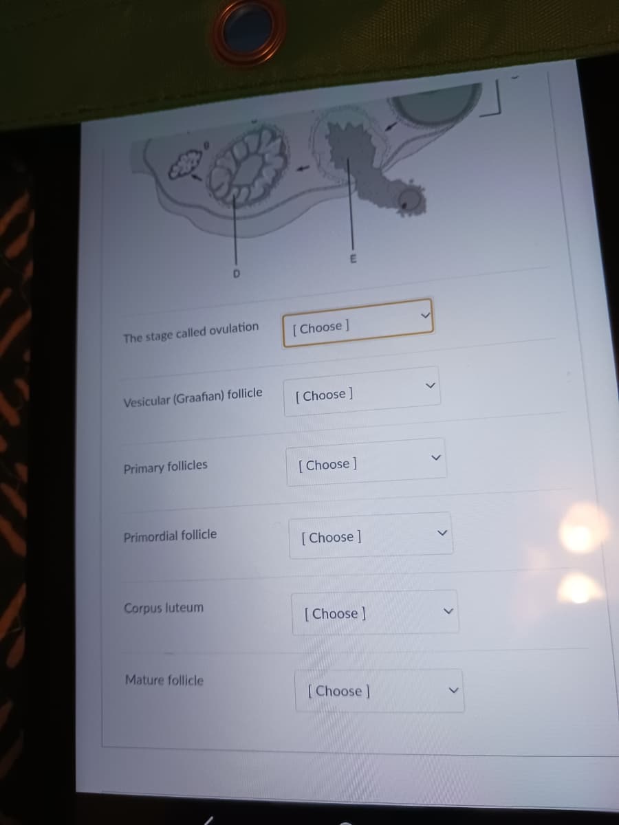 The stage called ovulation
Vesicular (Graafian) follicle
Primary follicles
Primordial follicle
Corpus luteum
Mature follicle
[Choose ]
[Choose ]
[Choose ]
[Choose ]
[Choose ]
[Choose ]