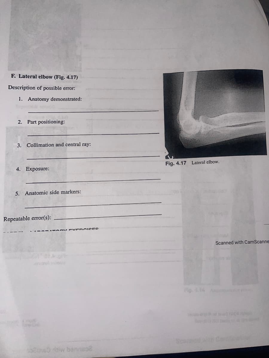 F. Lateral elbow (Fig. 4.17)
Description of possible error:
1. Anatomy demonstrated:
2. Part positioning:
3. Collimation and central ray:
4. Exposure:
5. Anatomic side markers:
Repeatable error(s):
EVEROISES
$5306 4nw bennuo2
Fig. 4.17 Lateral elbow.
Scanned with CamScanne