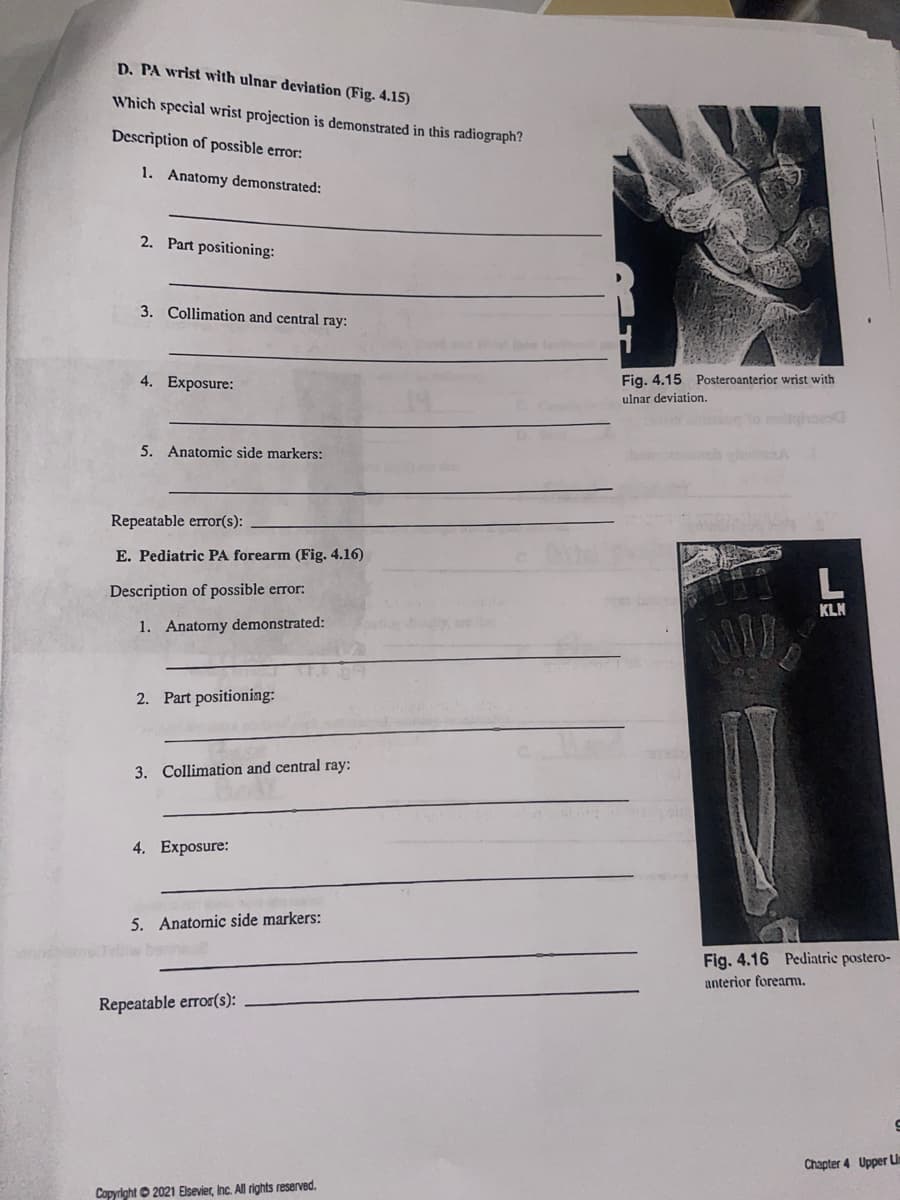 D. PA wrist with ulnar deviation (Fig. 4.15)
Which special wrist projection is demonstrated in this radiograph?
Description of possible error:
1. Anatomy demonstrated:
2. Part positioning:
3. Collimation and central ray:
4. Exposure:
5. Anatomic side markers:
Repeatable error(s):
E. Pediatric PA forearm (Fig. 4.16)
Description of possible error:
1. Anatomy demonstrated:
2. Part positioning:
3. Collimation and central ray:
4. Exposure:
5. Anatomic side markers:
Repeatable error(s):
Copyright 2021 Elsevier, Inc. All rights reserved.
Fig. 4.15 Posteroanterior wrist with
ulnar deviation.
L
KLN
Fig. 4.16 Pediatric postero-
anterior forearm.
9
Chapter 4 Upper Lis