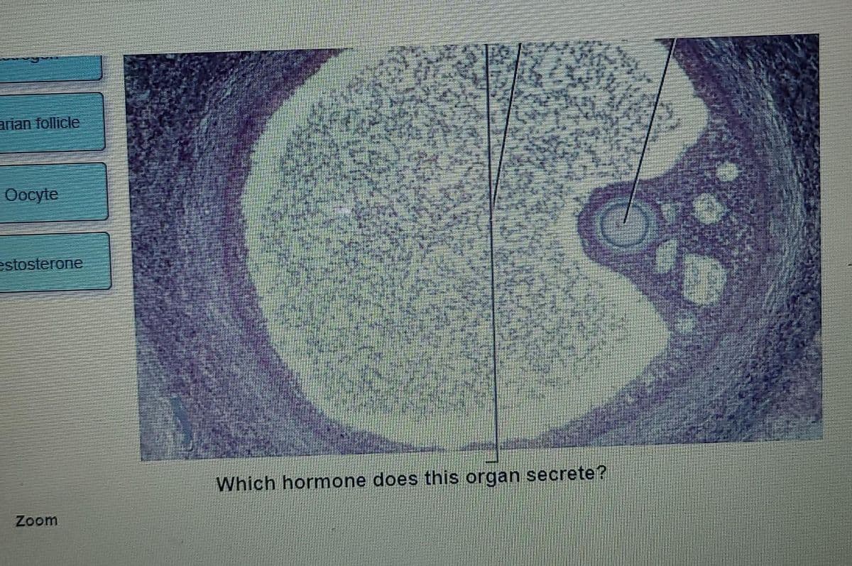 arian follicle
Oocyte
estosterone
Which hormone does this organ secrete?
Zoom
