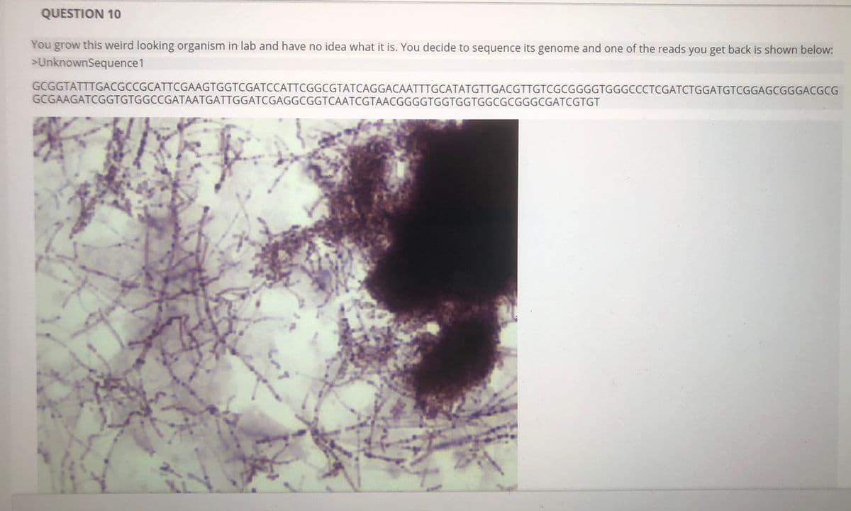 QUESTION 10
You grow this weird looking organism in lab and have no idea what it is. You decide to sequence its genome and one of the reads you get back is shown below:
>UnknownSequence1
GCGGTATTTGACGCCGCATTCGAAGTGGTCGATCCATTCGGCGTATCAGGACAATTTGCATATGTTGACGTTGTCGCGGGGTGGGCCCTCGATCTGGATGTCGGAGCGGGACGCG
GCGAAGATCGGTGTGGCCGATAATGATTGGATCGAGGCGGTCAATCGTAACGGGGTGGTGGTGGCGCGGGCGATCGTGT
