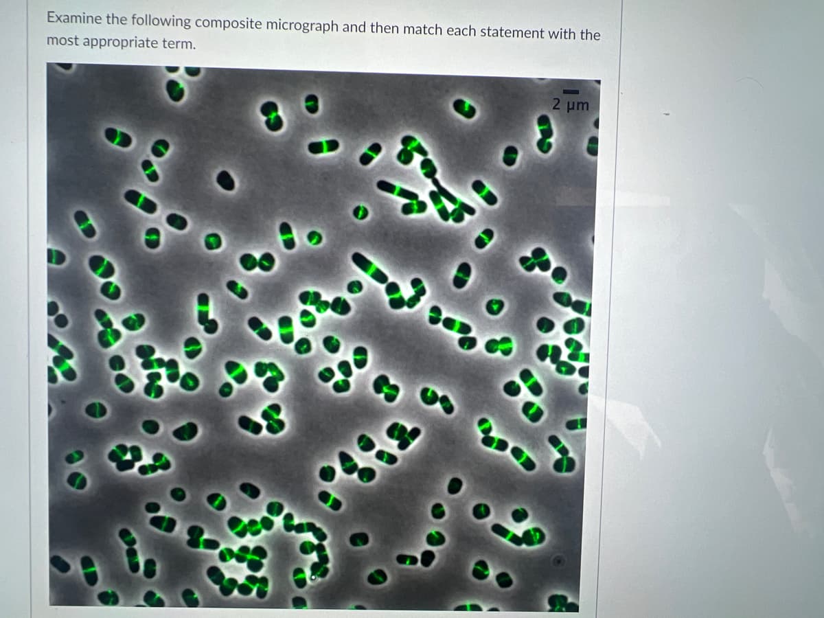 Examine the following composite micrograph and then match each statement with the
most appropriate term.
2 μm