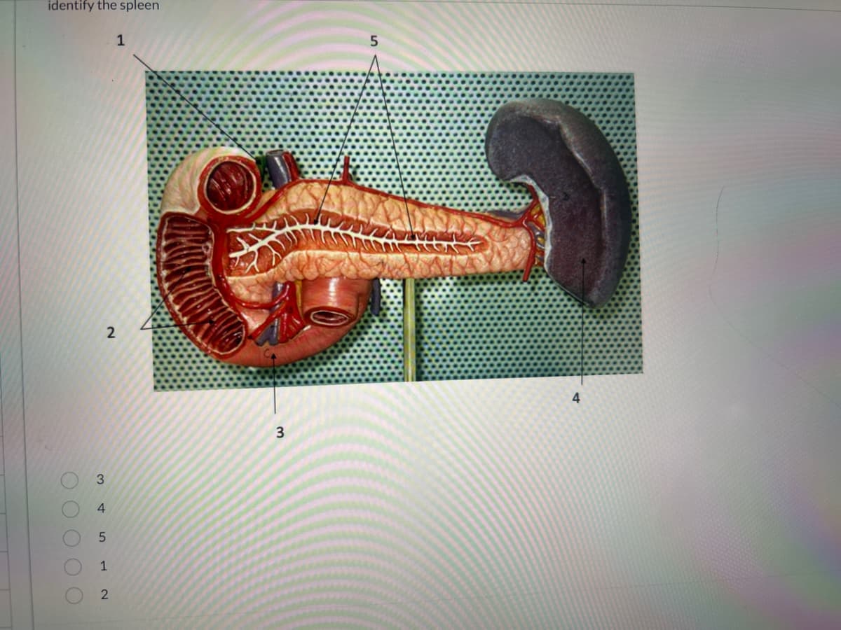 identify the spleen
3
2
5
1
1
2
3
4