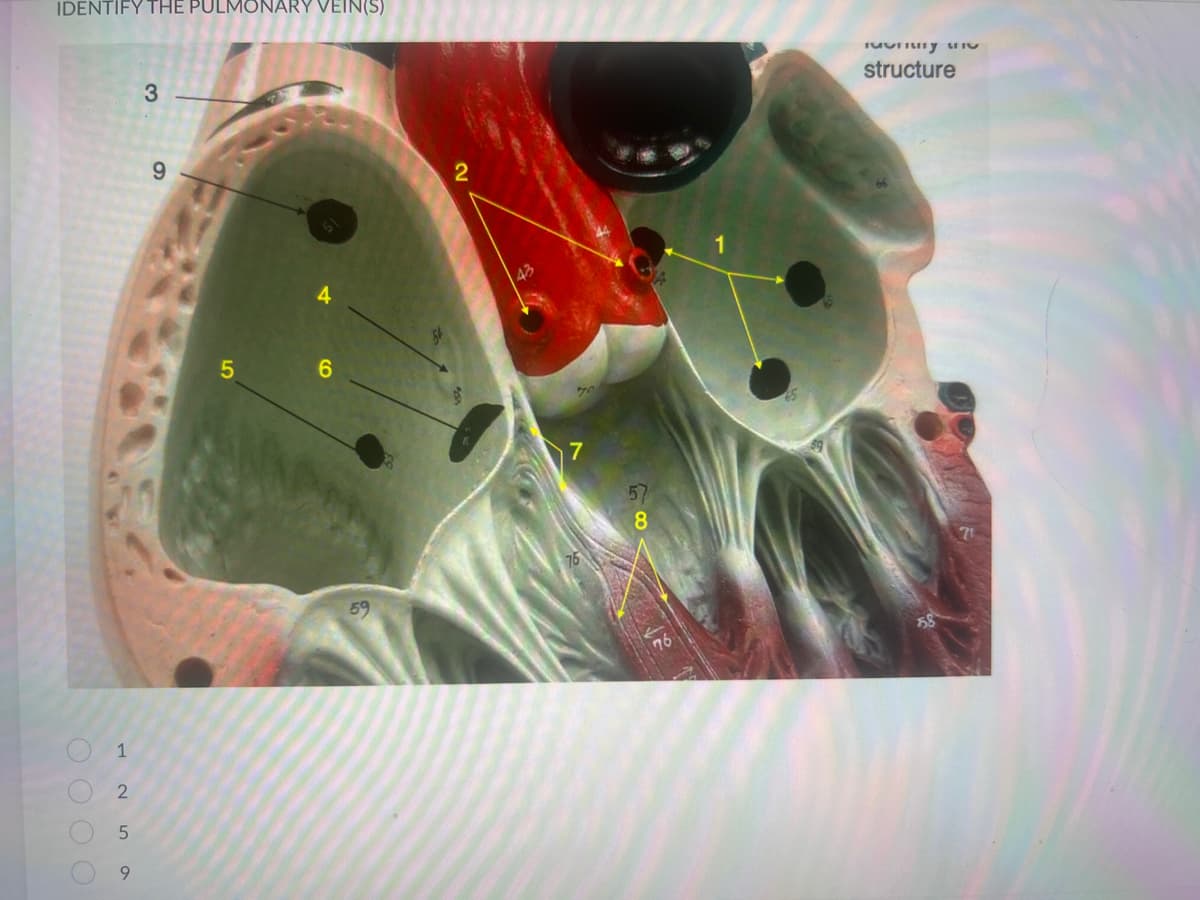 IDENTIFY THE PULMONARY VEIN(S)
0000
1
2
5
9
3
9
5
A
6
59
2
43
76
57
8
Monry S
structure
258