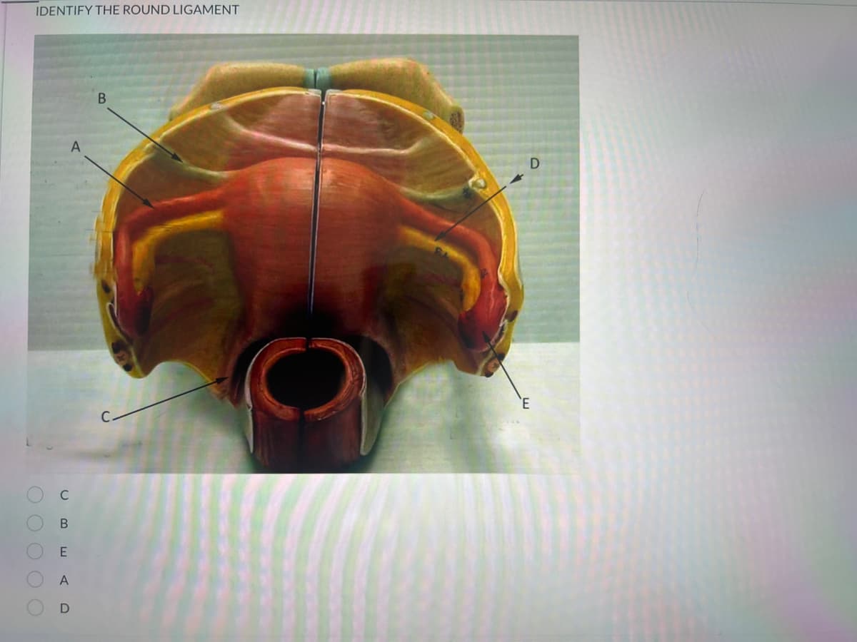 IDENTIFY THE ROUND LIGAMENT
0 0 0 0 0
с
B
E
A
D
В
'Е
D