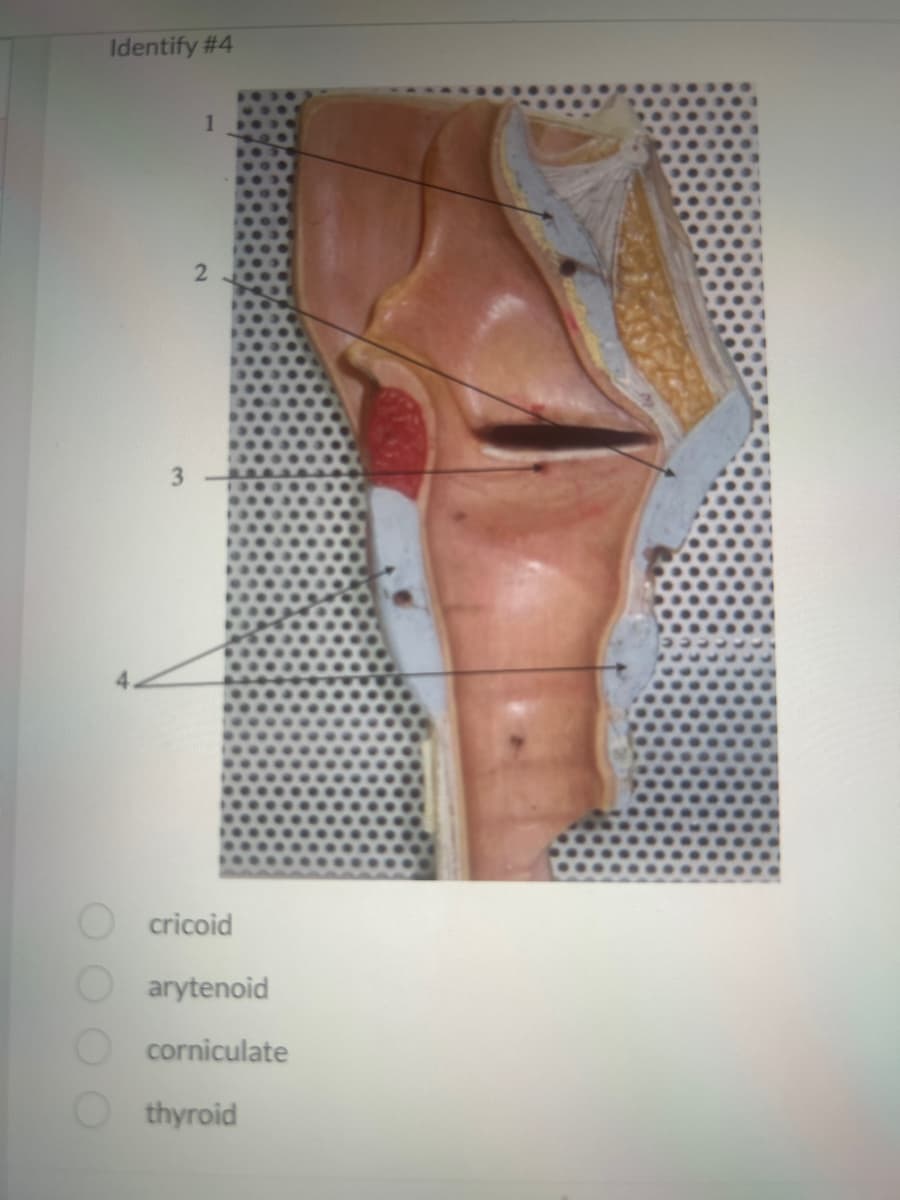 Identify #4
3
1
2
cricoid
arytenoid
corniculate
thyroid