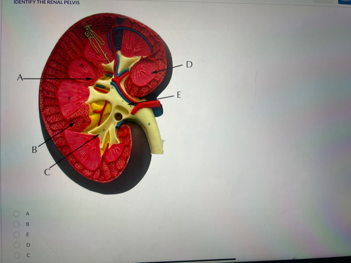 IDENTIFY THE RENAL PELVIS
А-
0 0 0 0 0
A
В
E
B
. D
E