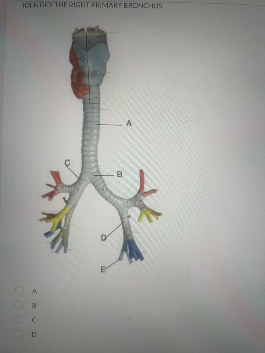 O O O O
IDENTIFY THE RIGHT PRIMARY BRONCHUS
A
B
B