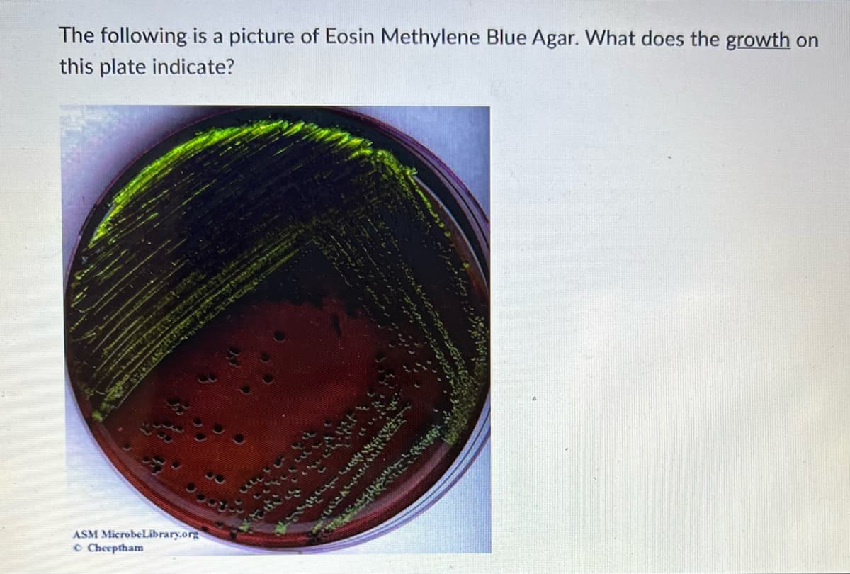 The following is a picture of Eosin Methylene Blue Agar. What does the growth on
this plate indicate?
ASM MicrobeLibrary.org
© Cheeptham
C
<LAZARABIA
Filesi