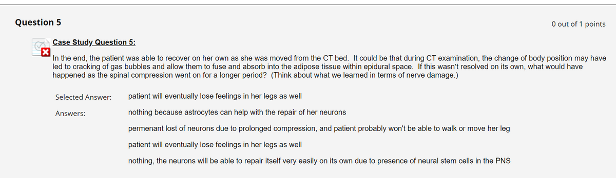 Question 5
Case Study Question 5:
In the end, the patient was able to recover on her own as she was moved from the CT bed. It could be that during CT examination, the change of body position may have
led to cracking of gas bubbles and allow them to fuse and absorb into the adipose tissue within epidural space. If this wasn't resolved on its own, what would have
happened as the spinal compression went on for a longer period? (Think about what we learned in terms of nerve damage.)
Selected Answer:
Answers:
0 out of 1 points
patient will eventually lose feelings in her legs as well
nothing because astrocytes can help with the repair of her neurons
permenant lost of neurons due to prolonged compression, and patient probably won't be able to walk or move her leg
patient will eventually lose feelings in her legs as well
nothing, the neurons will be able to repair itself very easily on its own due to presence of neural stem cells in the PNS