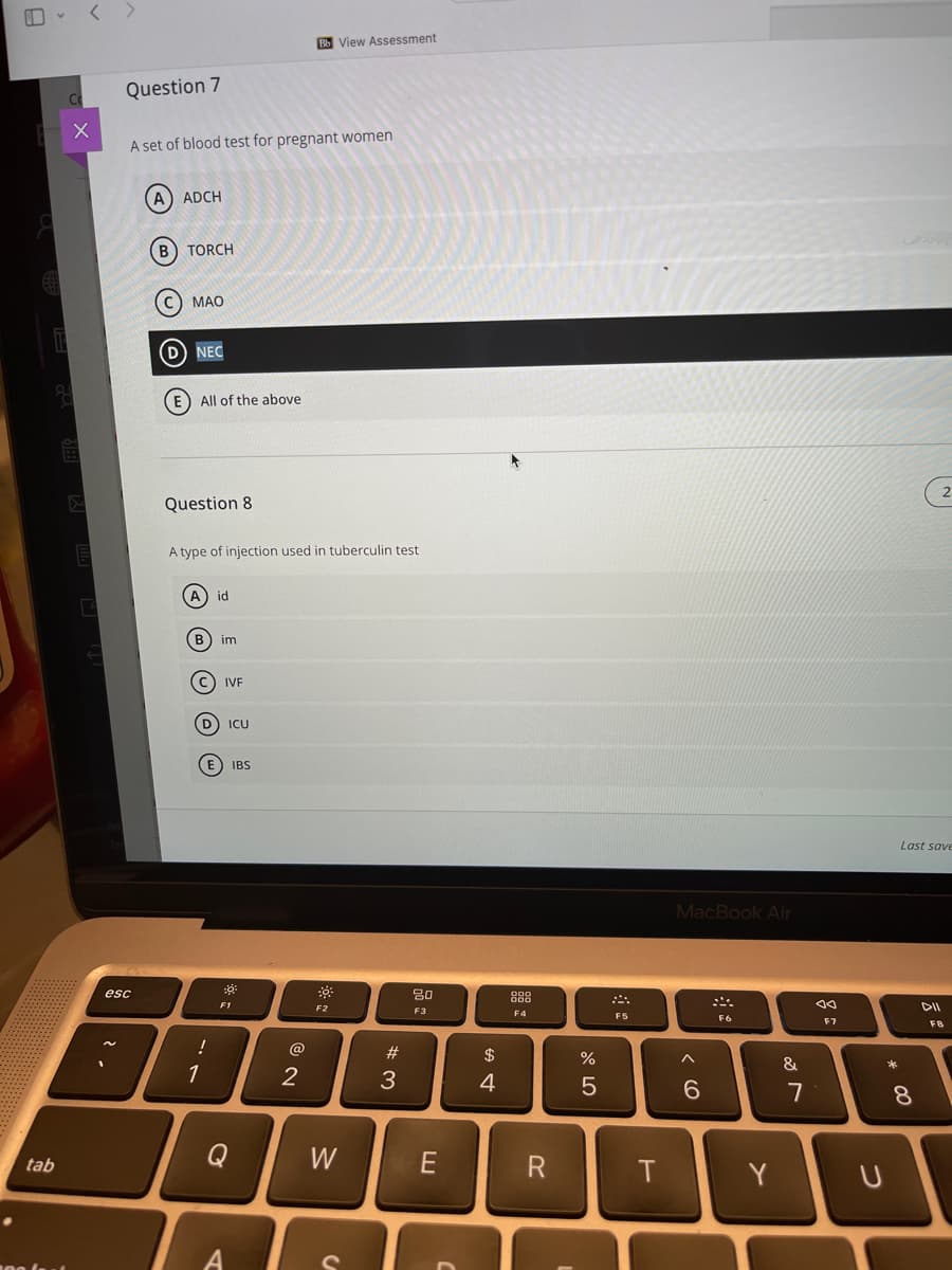 < >
B View Assessment
Question 7
A set of blood test for pregnant women
A ADCH
B) TORCH
C) MAO
D NEC
E) All of the above
Question 8
A type of injection used in tuberculin test
A) id
im
IVF
D
ICU
E) IBS
Last save
MacBook Air
esc
80
F1
F2
DII
F3
F4
F6
F7
F8
!
@
#
$
&
1
2
3
4
7
Q
W
tab
Y
* CO
つ
くO
