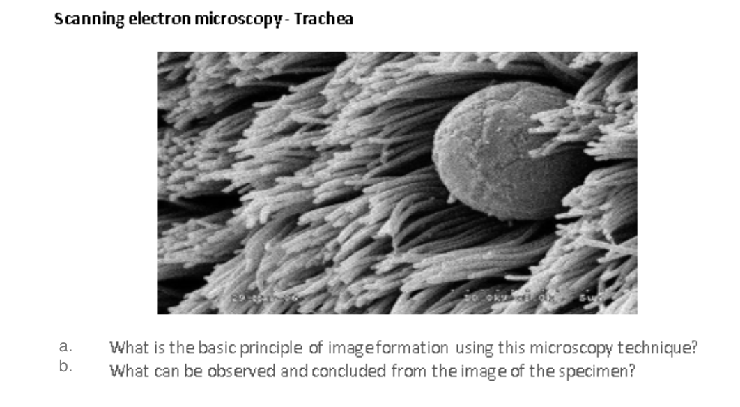 Scanning electron microscopy - Trachea
a.
b.
20 Oky CEL 0x Sun
What is the basic principle of image formation using this microscopy technique?
What can be observed and concluded from the image of the specimen?