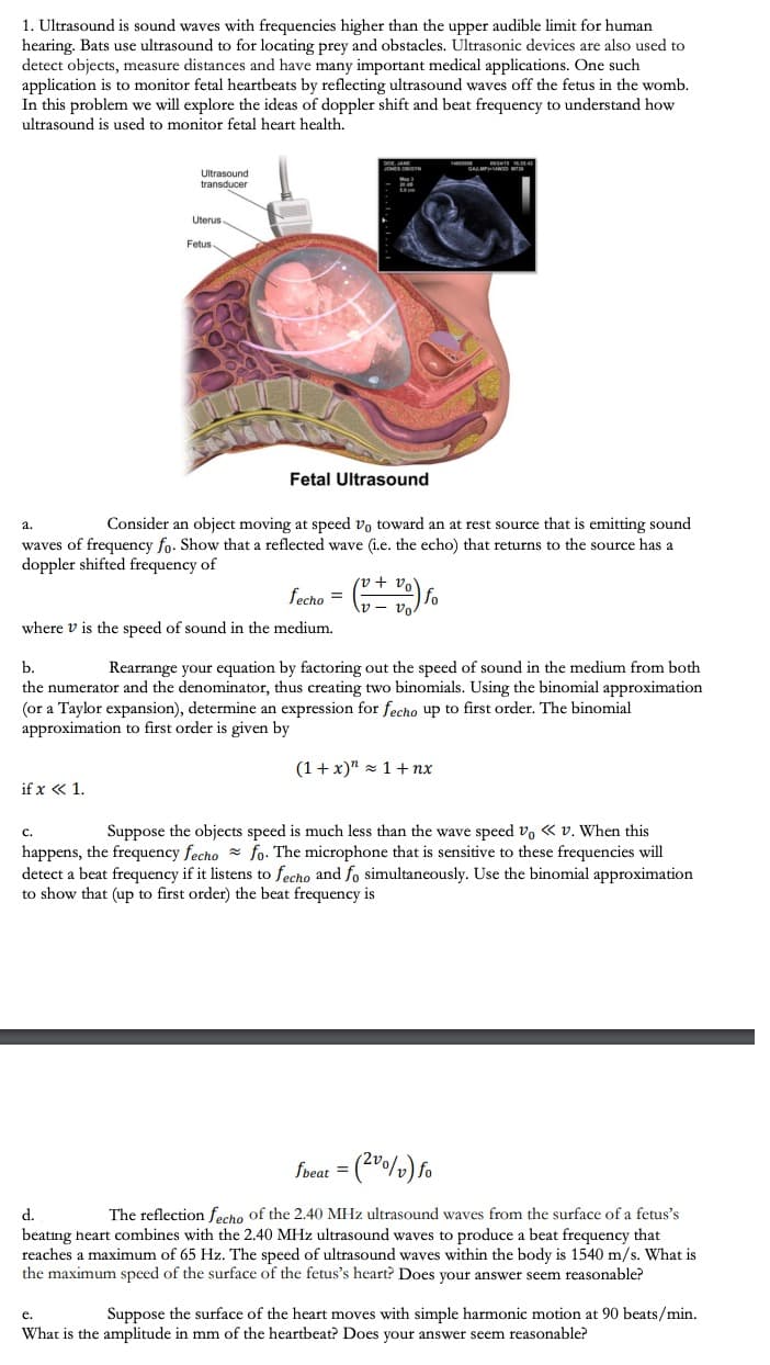 1. Ultrasound is sound waves with frequencies higher than the upper audible limit for human
hearing. Bats use ultrasound to for locating prey and obstacles. Ultrasonic devices are also used to
detect objects, measure distances and have many important medical applications. One such
application is to monitor fetal heartbeats by reflecting ultrasound waves off the fetus in the womb.
In this problem we will explore the ideas of doppler shift and beat frequency to understand how
ultrasound is used to monitor fetal heart health.
Ultrasound
transducer
Uterus-
Fetus
Fetal Ultrasound
a.
Consider an object moving at speed vo toward an at rest source that is emitting sound
waves of frequency fo. Show that a reflected wave (i.e. the echo) that returns to the source has a
doppler shifted frequency of
feceno = ) fo
where v is the speed of sound in the medium.
b.
Rearrange your equation by factoring out the speed of sound in the medium from both
the numerator and the denominator, thus creating two binomials. Using the binomial approximation
(or a Taylor expansion), determine an expression for fecho up to first order. The binomial
approximation to first order is given by
(1+ x)" z 1+ nx
if x « 1.
Suppose the objects speed is much less than the wave speed vo « v. When this
happens, the frequency fecho fo. The microphone that is sensitive to these frequencies will
detect a beat frequency if it listens to fecho and fo simultaneously. Use the binomial approximation
to show that (up to first order) the beat frequency is
foeat = (2"0/») fo
The reflection fecho of the 2.40 MHz ultrasound waves from the surface of a fetus's
beatıng heart combines with the 2.40 MHz ultrasound waves to produce a beat frequency that
reaches a maximum of 65 Hz. The speed of ultrasound waves within the body is 1540 m/s. What is
the maximum speed of the surface of the fetus's heart? Does your answer seem reasonable?
d.
Suppose the surface of the heart moves with simple harmonic motion at 90 beats/min.
е.
What is the amplitude in mm of the heartbeat? Does your answer seem reasonable?
