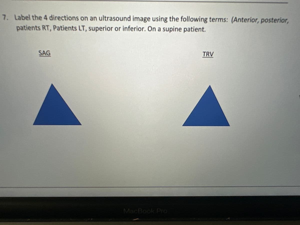 7. Label the 4 directions on an ultrasound image using the following terms: (Anterior, posterior,
patients RT, Patients LT, superior or inferior. On a supine patient.
SAG
MacBook Pro
TRV