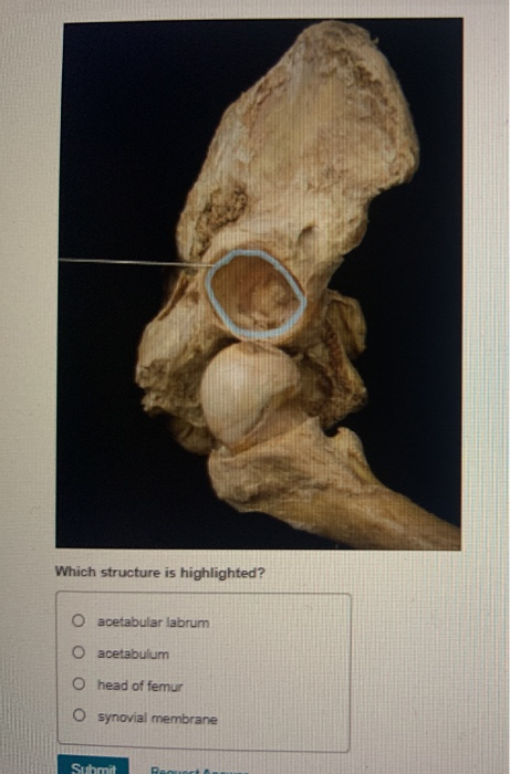 Which structure is highlighted?
O acetabular labrum
O acetabulum
O head of femur
O synovial membrane
Submit
Requert &