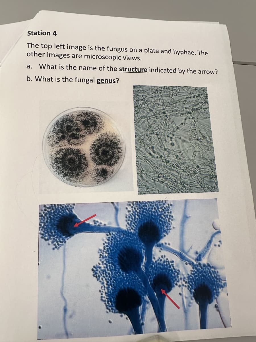 Station 4
The top left image is the fungus on a plate and hyphae. The
other images are microscopic views.
a. What is the name of the structure indicated by the arrow?
b. What is the fungal genus?