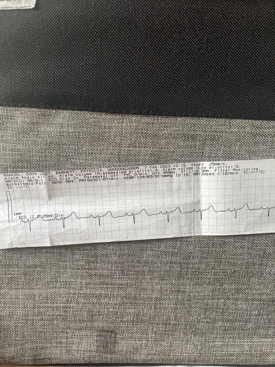 MANUAL, ICU4-2527, BARNETT, PATRICIA, 000000626805, 7 Feb 2023 10:19. Speed: 25mm/s,
Alarm Audio:All on. Alarm volume (High&medium priority):4, Alarm volume (Low priority> :3,
Pacemaker Off, PVC:0/min, QTc: 459ms, ST(I):0.3mm, Filter Monitoring,
HR(ECG) 66/min, ECG Size:2x,
Arrhythmia Fuli. SpO2 96%, PR<SP02):67/min. NIBP 134/63(91)mmHg 10 15. RRC Imped. 10/min, T1
T2:---C
1mV
ECG II 25mV/Div
My