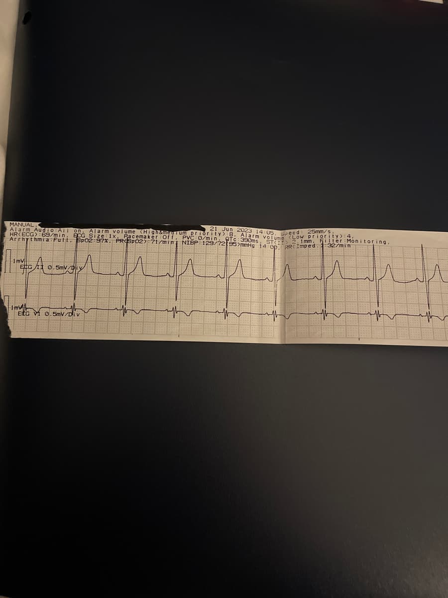 MANUAL.
Alarm Audio: All on, Alarm volume (High&medio in QTc: 390ms, ST(IT
HR(ECG):69/min, ECG Size: 1x, Pacemaker: Off,
Arrhythmia
1mV
EDG
0.5mV/Di
A
10.5mV/D
25mm/s,
21 Jun 2023 14:05. Spet priority):
:8, Alarm volu
volume
NIBP: 129/72195)mmHg 14 00 RRC Imped. 32/min
2.1mm, Filter Monitoring.
uffer
الب
سله