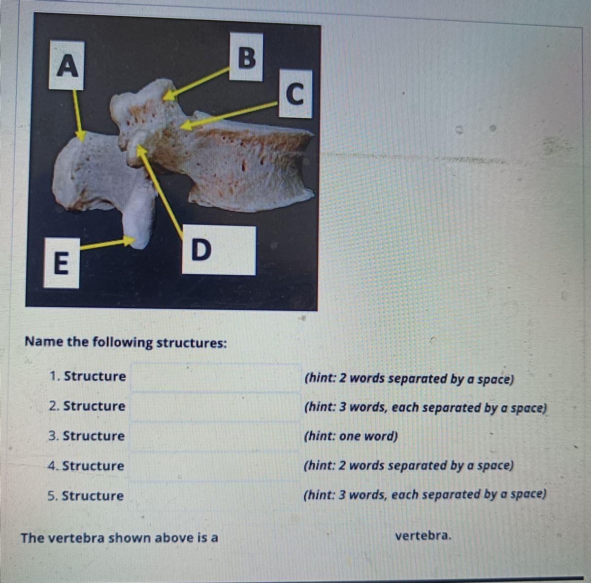 A
E
Name the following structures:
1. Structure
2. Structure
3. Structure
4. Structure
D
5. Structure
The vertebra shown above is a
B
C
(hint: 2 words separated by a space)
(hint: 3 words, each separated by a space)
(hint: one word)
(hint: 2 words separated by a space)
(hint: 3 words, each separated by a space)
vertebra.