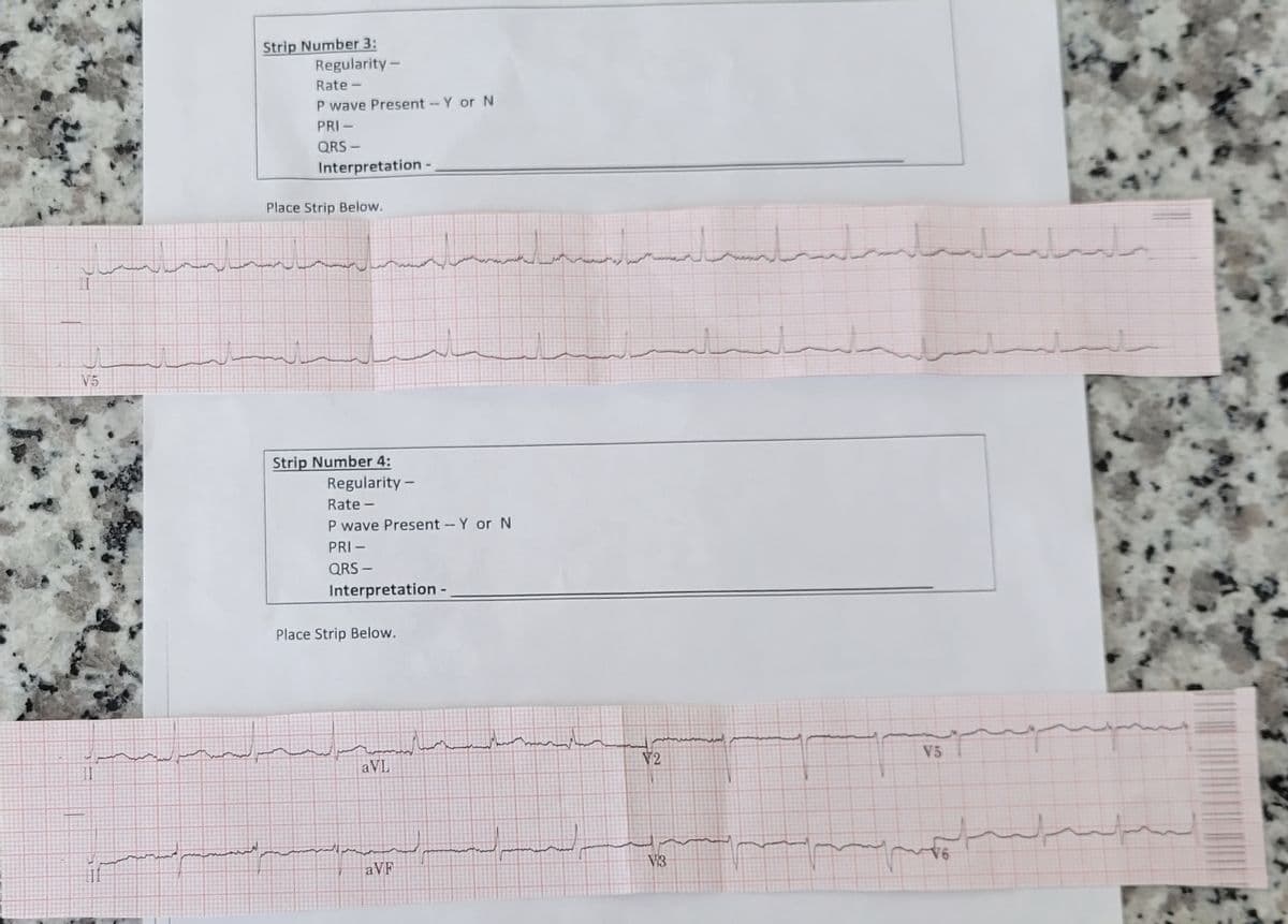 سديستان
V5
I
است
Strip Number 3:
Regularity -
Rate -
P wave Present - Y or N
PRI -
ORS –
Interpretation -
Place Strip Below.
un
Strip Number 4:
Regularity -
Rate -
P wave Present -- Y or N
PRI –
QRS -
Interpretation -_
Place Strip Below.
aVL
سنساء
aVF
سیار مست ما
لیس بسته به
72
3
75
ماليد
السداد