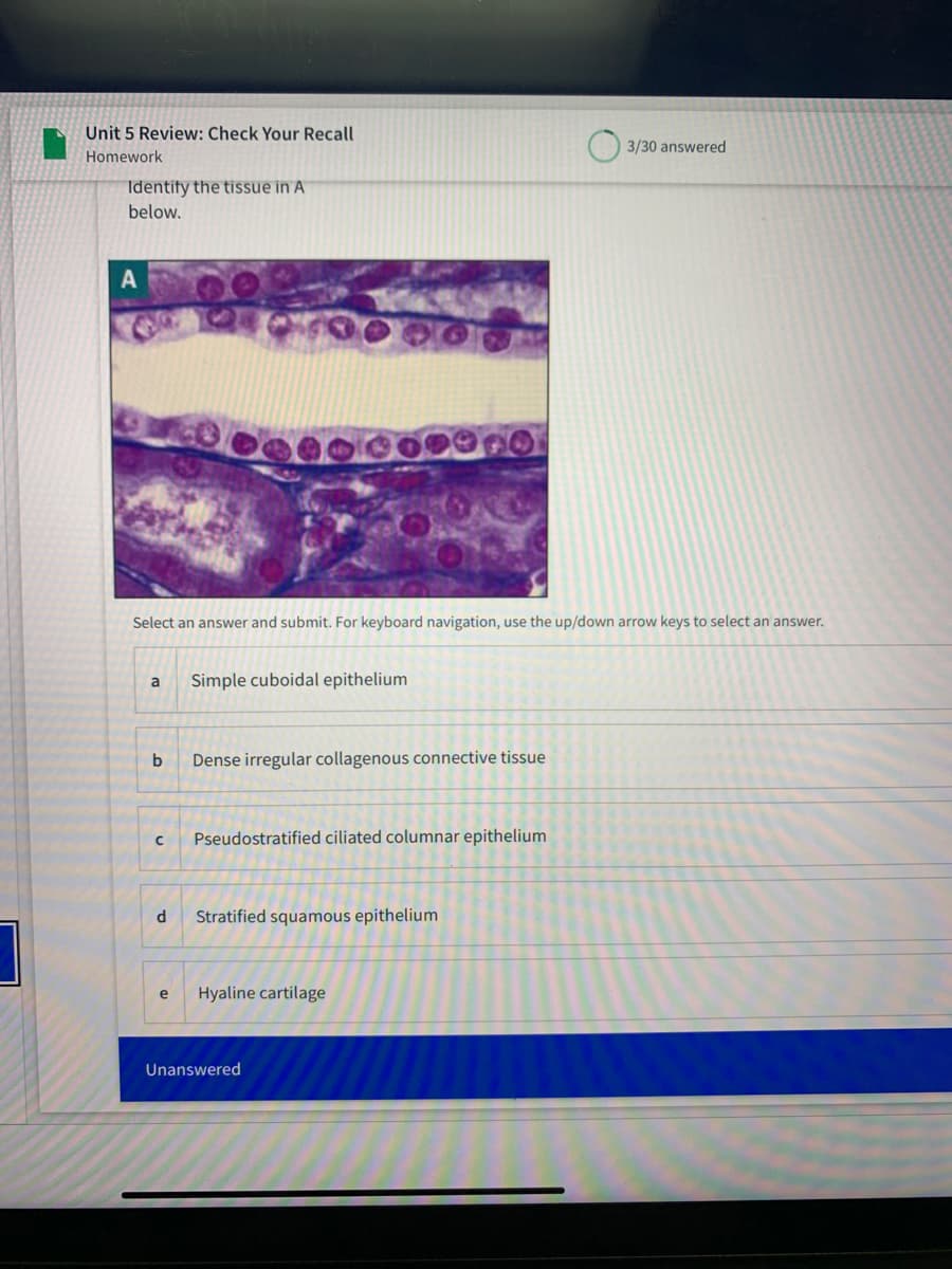 Unit 5 Review: Check Your Recall
3/30 answered
Homework
Identify the tissue in A
below.
A
Select an answer and submit. For keyboard navigation, use the up/down arrow keys to select an answer.
Simple cuboidal epithelium
b
Dense irregular collagenous connective tissue
Pseudostratified ciliated columnar epithelium
d
Stratified squamous epithelium
e
Hyaline cartilage
Unanswered
