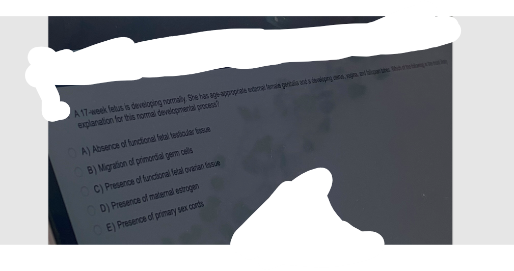 A 17-week fetus is developing normally. She has age-appropriate extemal female genitalia and a developing uterus, vagina, and talopan tubes. Which of the blowing is the most kay
explanation for this normal developmental process?
OA) Absence of functional fetal testicular tissue
B) Migration of primordial germ cells
OC) Presence of functional fetal ovarian tissue
OD) Presence of maternal estrogen
E) Presence of primary sex cords