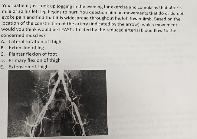 Your patient just took up jogging in the evening for exercise and complains that after a
mile or so his left leg begins to hurt. You question him on movements that do or do not
evoke pain and find that it is widespread throughout his left lower limb. Based on the
location of the constriction of the artery (indicated by the arrow), which movement
would you think would be LEAST affected by the reduced arterial blood flow to the
concerned muscles?
A. Lateral rotation of thigh
B. Extension of leg
C. Plantar flexion of foot
D. Primary flexion of thigh
E. Extension of thigh