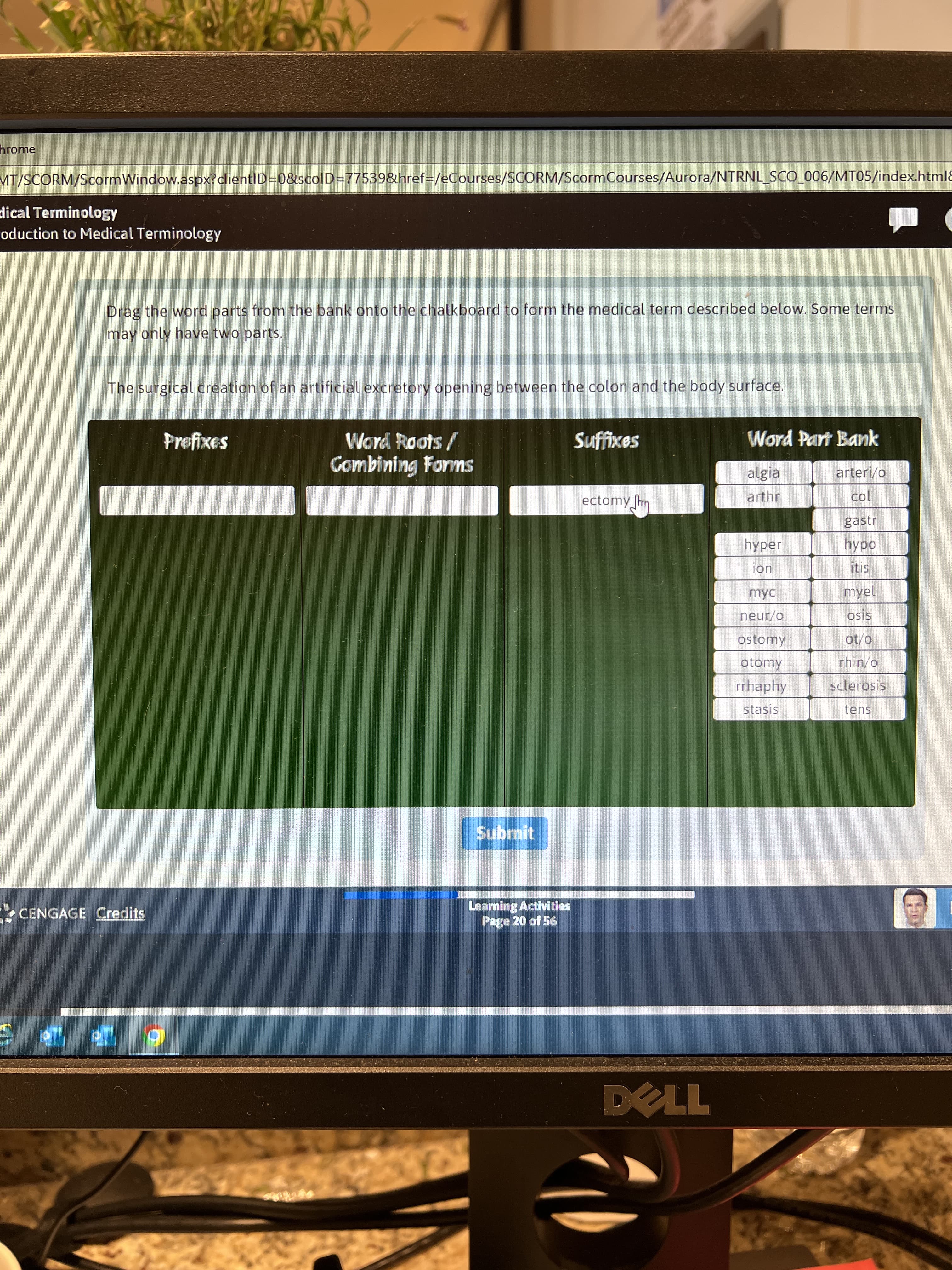 hrome
MT/SCORM/ScormWindow.aspx?clientID=0&scolD=D77539&href=D/eCourses/SCORM/ScormCourses/Aurora/NTRNL_SCO_006/MT05/index.html8
dical Terminology
oduction to Medical Terminology
Drag the word parts from the bank onto the chalkboard to form the medical term described below. Some terms
may only have two parts.
The surgical creation of an artificial excretory opening between the colon and the body surface.
Word Part Bank
Word Roots/
Combining Forms
Prefixes
Suffixes
algia
arteri/o
ectomy
arthr
col
gastr
hyper
myel
neur/o
osis
0/10
rhin/o
ostomy
otomy
rrhaphy
sclerosis
stasis
Submit
CENGAGE Credits
Learning Activities
Page 20 of 56
0ךד
