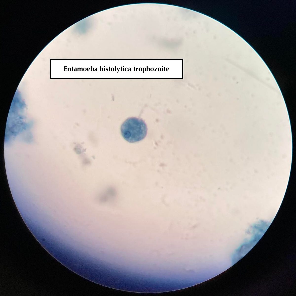 Entamoeba histolytica trophozoite