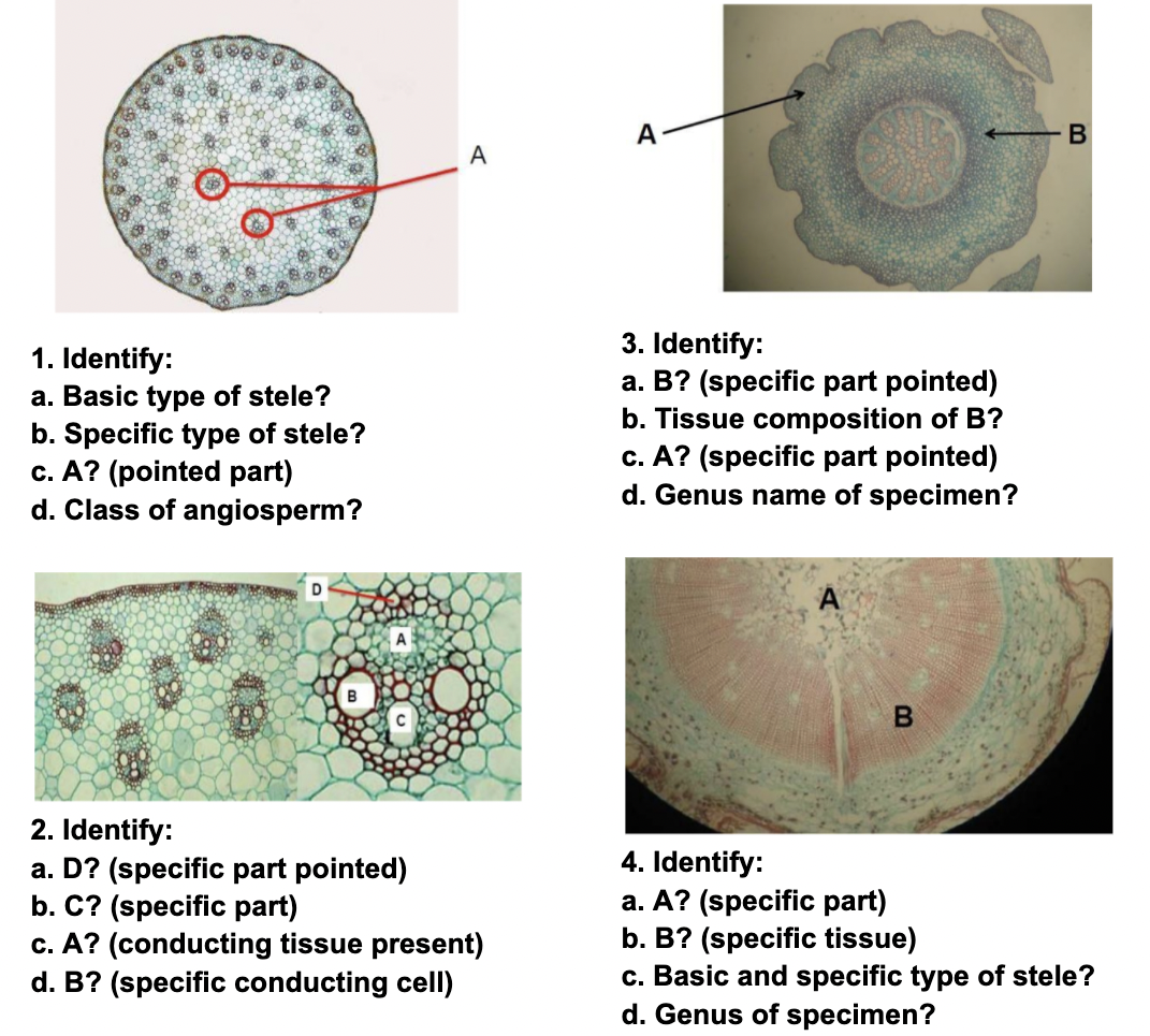 А
В
A
3. Identify:
a. B? (specific part pointed)
b. Tissue composition of B?
c. A? (specific part pointed)
d. Genus name of specimen?
1. Identify:
a. Basic type of stele?
b. Specific type of stele?
c. A? (pointed part)
d. Class of angiosperm?
D
A
B
2. Identify:
a. D? (specific part pointed)
b. C? (specific part)
c. A? (conducting tissue present)
d. B? (specific conducting cell)
4. Identify:
a. A? (specific part)
b. B? (specific tissue)
c. Basic and specific type of stele?
d. Genus of specimen?
