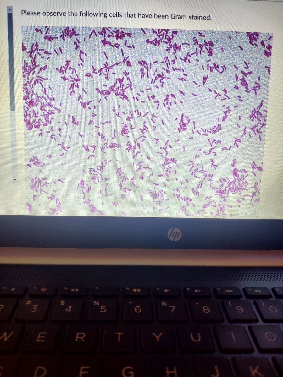 N
Please observe the following cells that have been Gram stained.
"*
3
E
ER
$
JO
4
R
%
5
6
F G
&
Y
I
U
8
00