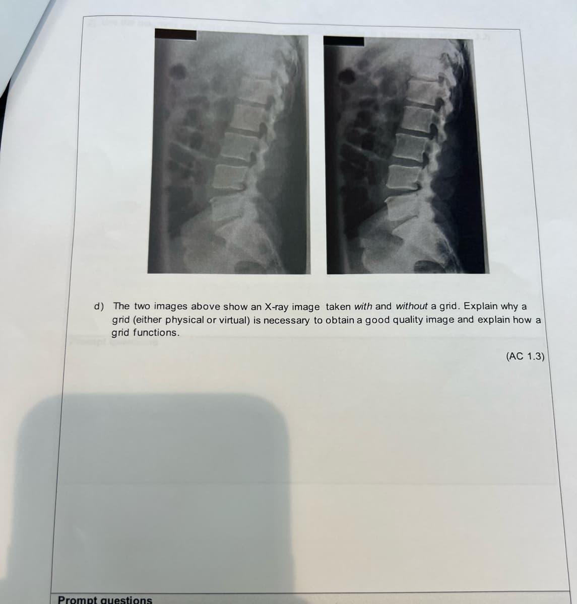 d) The two images above show an X-ray image taken with and without a grid. Explain why a
grid (either physical or virtual) is necessary to obtain a good quality image and explain how a
grid functions.
Prompt questions
(AC 1.3)