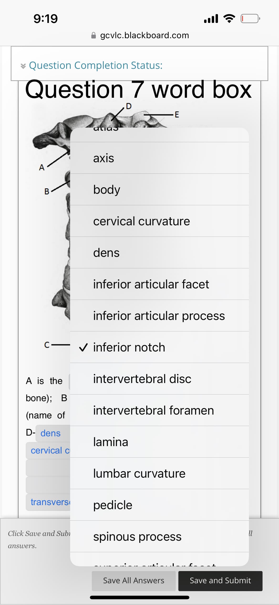 9:19
Question Completion Status:
Question 7 word box
D
A
B
A is the
bone); B
(name of
D- dens
cervical c
answers.
transvers
gcvlc.blackboard.com
Click Save and Subi
alias
axis
body
c-✓ inferior notch
cervical curvature
dens
inferior articular facet
E
inferior articular process
intervertebral disc
lamina
intervertebral foramen
all ?
lumbar curvature
pedicle
spinous process
Save All Answers
11
Save and Submit