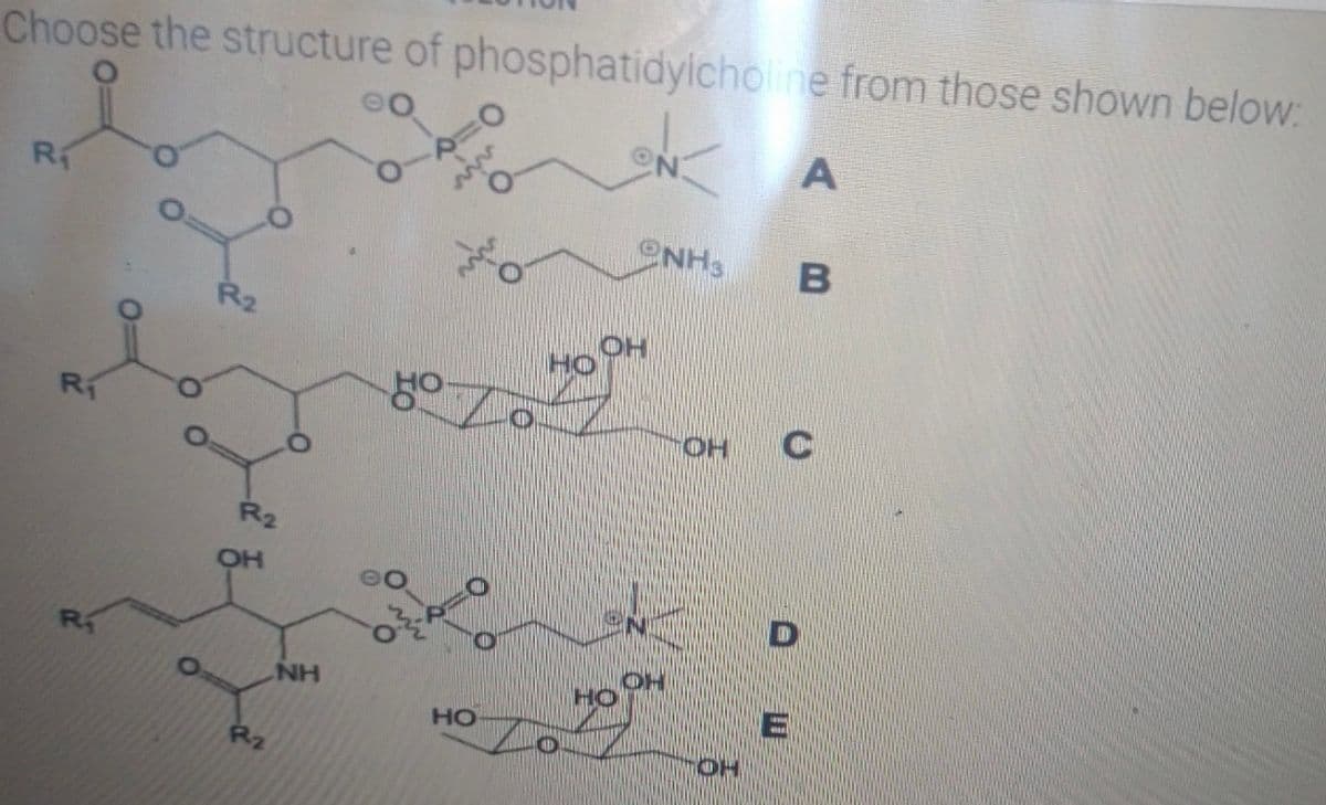 Choose the structure of phosphatidylcholine from those shown below:
R₁
R₁
R₁
R2
R₂
OH
Rz
NH
H
HO
o
O
NA
2NH3
OH
OH
OH
B
I
D