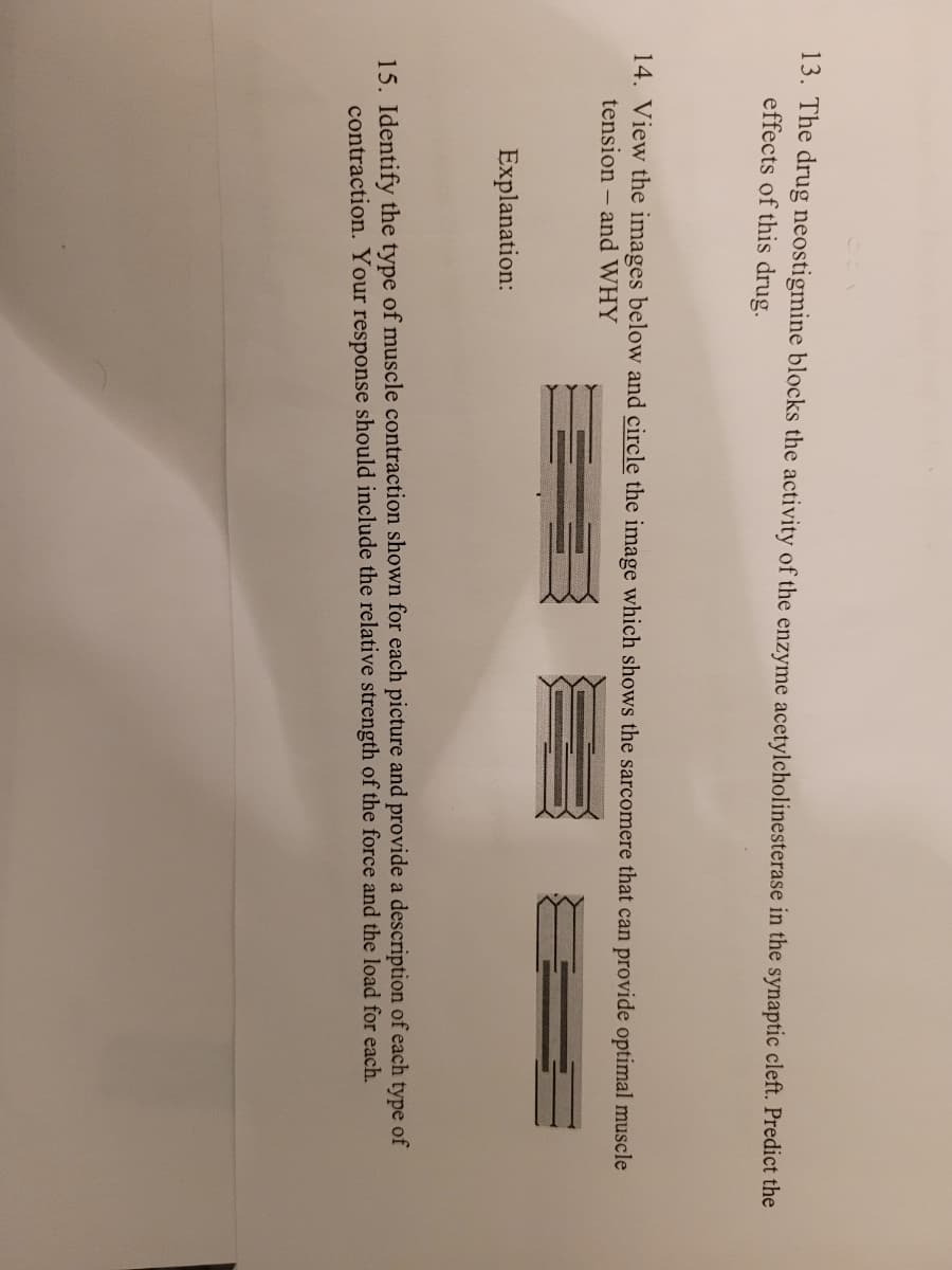 13. The drug neostigmine blocks the activity of the enzyme acetylcholinesterase in the synaptic cleft. Predict the
effects of this drug.
14. View the images below and circle the image which shows the sarcomere that can provide optimal muscle
tension – and WHY
Explanation:
15. Identify the type of muscle contraction shown for each picture and provide a description of each
contraction. Your response should include the relative strength of the force and the load for each.
type
of
