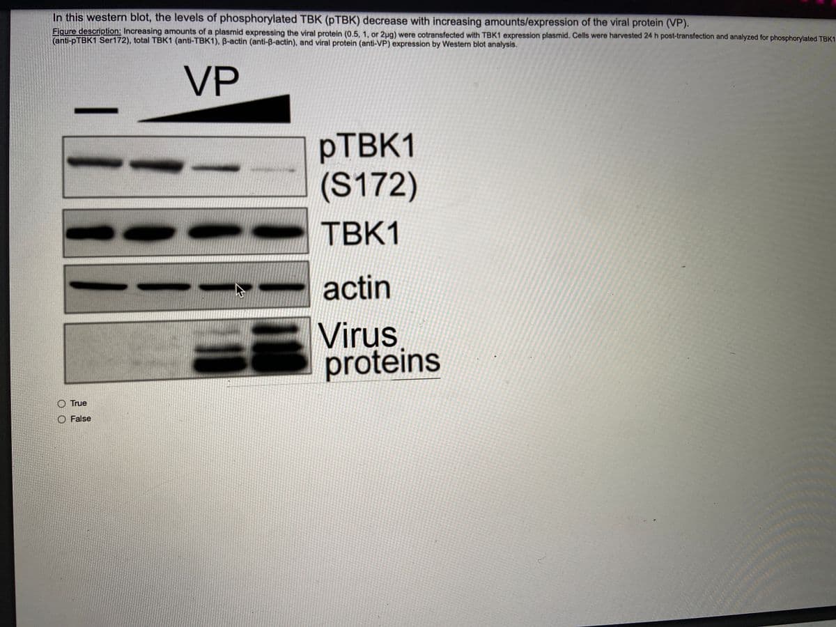 In this western blot, the levels of phosphorylated TBK (PTBK) decrease with increasing amounts/expression of the viral protein (VP).
Figure description: Increasing amounts of a plasmid expressing the viral protein (0.5, 1, or 2ug) were cotransfected with TBK1 expression plasmid. Cells were harvested 24 h post-transfection and analyzed for phosphorylated TBK1
(anti- TBK1 Ser172), total TBK1 (anti-TBK1), B-actin (anti-B-actin), and viral protein (anti-VP) expression by Western blot analysis.
VP
PTBK1
(S172)
TBK1
actin
Virus
proteins
O True
O False
