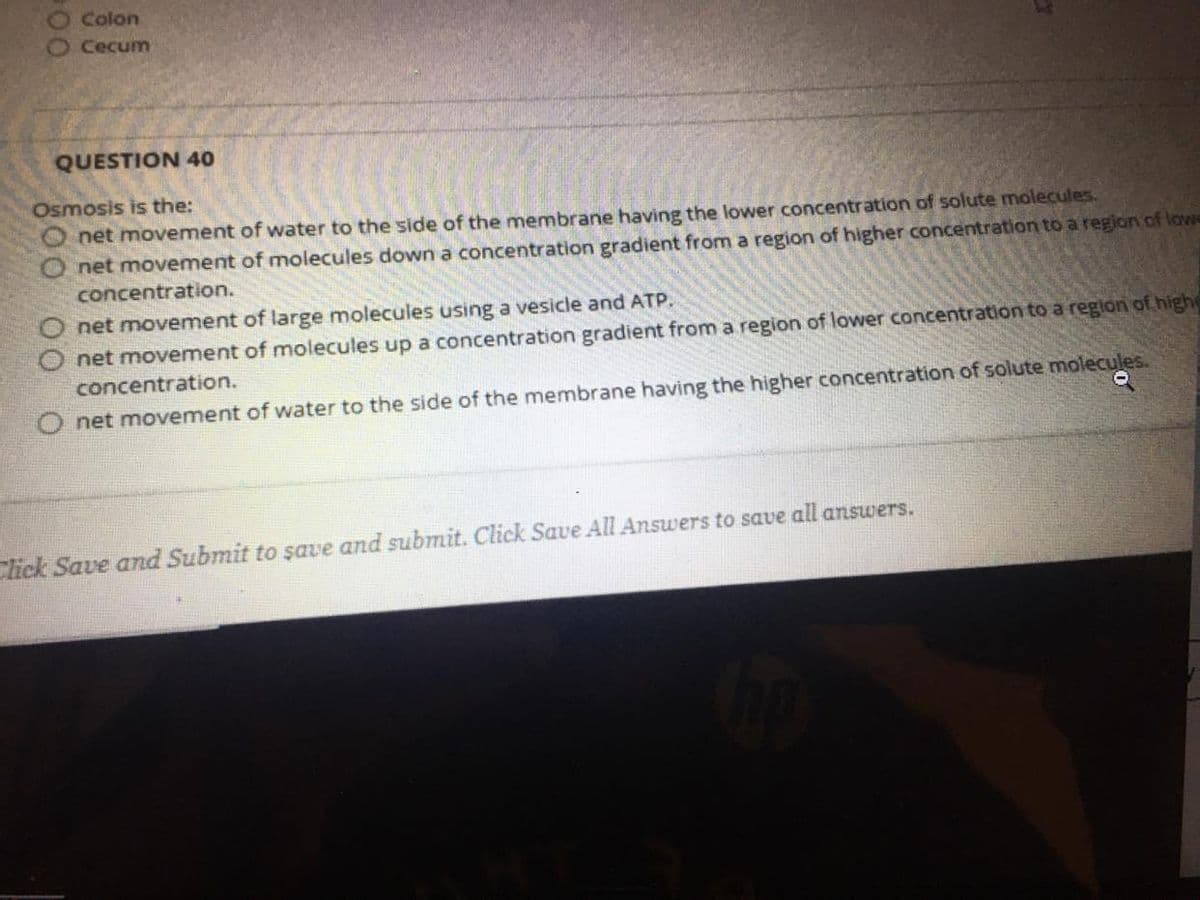 Colon
Cecum
QUESTION 40
Osmosis is the:
net movement of water to the side of the membrane having the lower concentration of solute molecules.
net movement of molecules down a concentration gradient from a region of higher concentration to a region of lowe
concentration.
net movement of large molecules using a vesicle and ATP.
net movement of molecules up a concentration gradient from a region of lower concentration to a region of high
concentration.
O net movement of water to the side of the membrane having the higher concentration of solute molecules.
Click Save and Submit to șave and submit. Click Save All Answers to save all answers.
800
00
