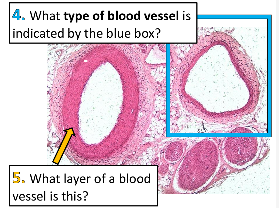 4. What type of blood vessel is
indicated by the blue box?
5. What layer of a blood
vessel is this?