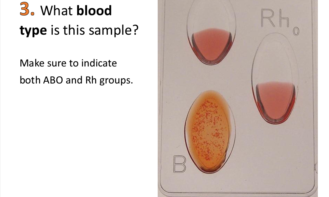 3. What blood
type is this sample?
Make sure to indicate
both ABO and Rh groups.
Rho