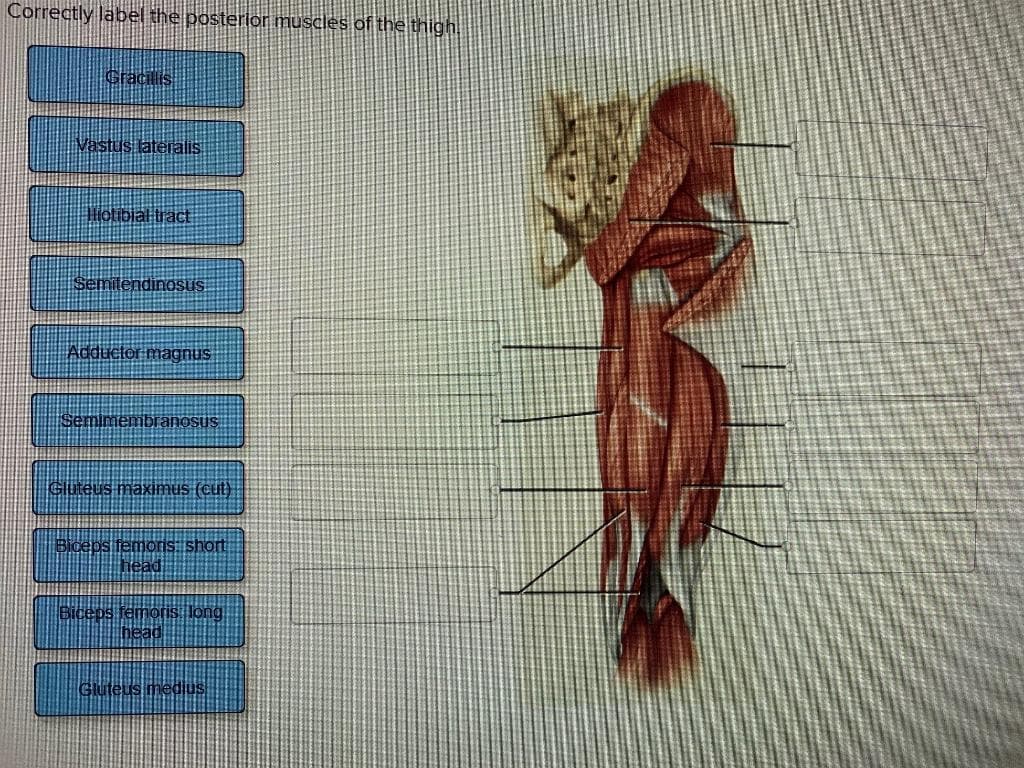 Correctly läbel the posterior muscles of the thigh.
Gracilis
Vastus lateralis
otibial tract
Semitendinosus
Adductor magnus
Semimembranosus
Gueus maximus (cut)
Bioeb
moris:short
head
Guteus medius
