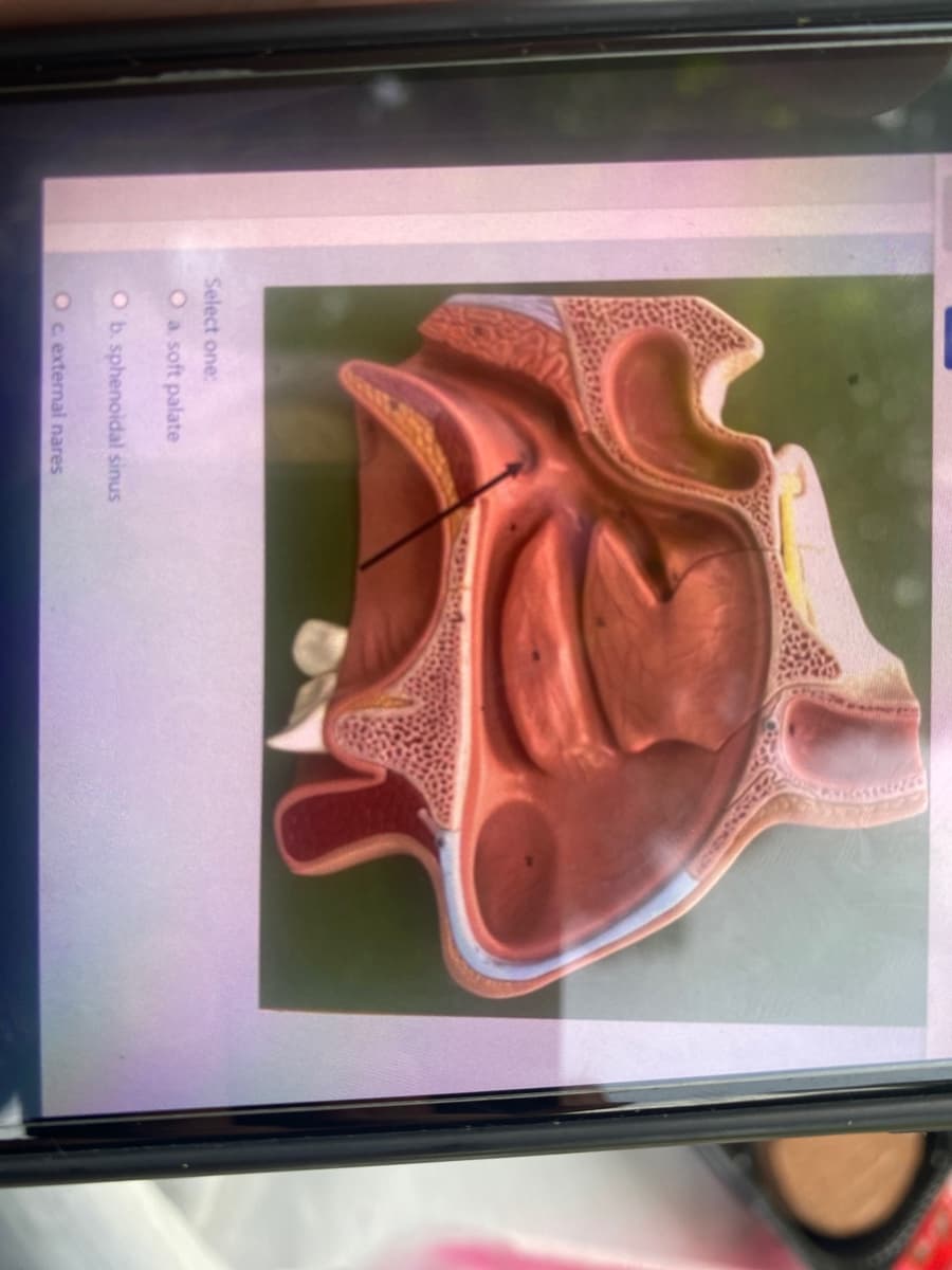 Select one:
Oa soft palate
Ob. sphenoidal sinus
Oc external nares
