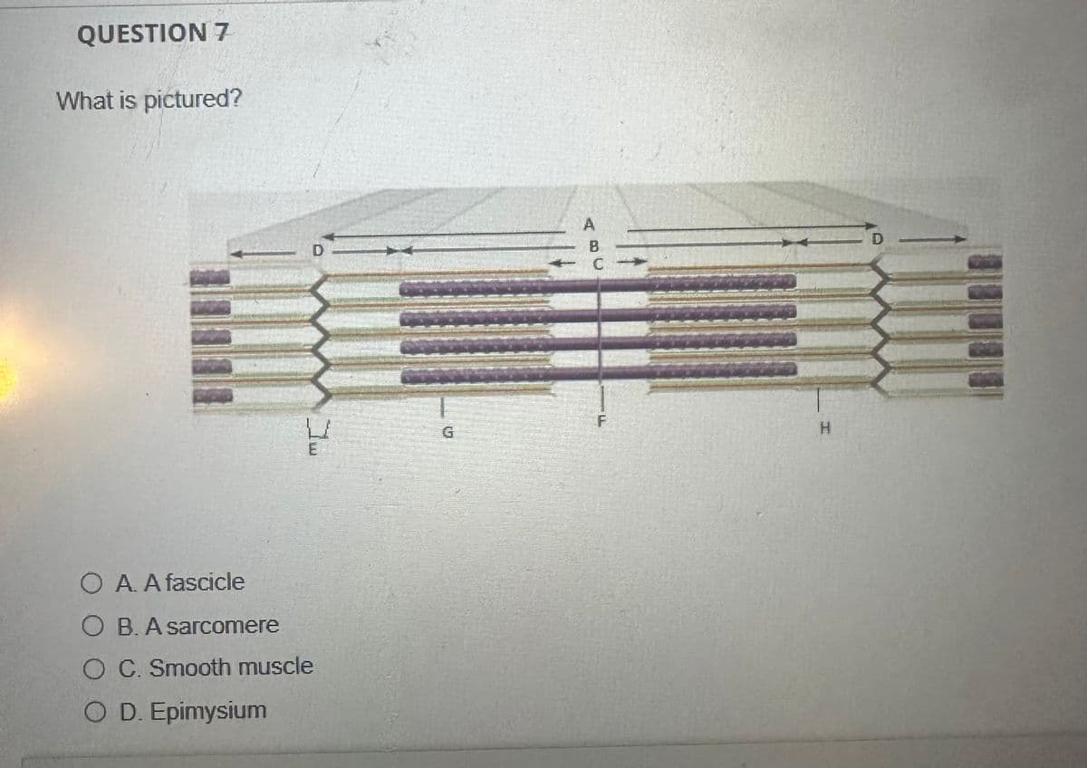 QUESTION 7
What is pictured?
OA. A fascicle
O B. A sarcomere
O C. Smooth muscle
O D. Epimysium
D
A
B
C
ப
F
H
E
D